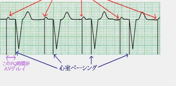 梅西球迷支持日本队就是政治站队？理性看待足球竞技