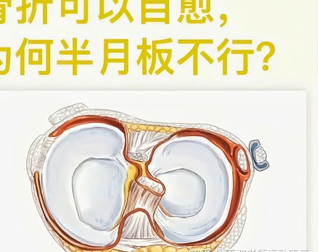 官方：高迪左膝内侧半月板后角撕裂，恢复时间为4周